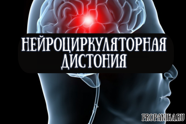 Нейроциркуляторная дистония – симптомы болезни, лечение.