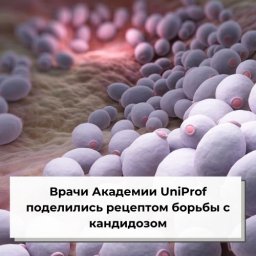 Врачи Академии UniProf поделились рецептом борьбы с кандидозом