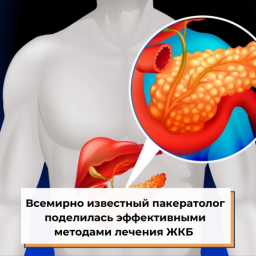 Всемирно известный пакератолог поделилась эффективными методами лечения ЖКБ Всемирно известный пакератолог поделилась эффективными методами лечения ЖКБ