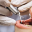 Имплантация зубов в UniverStom